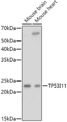 Western Blot: TP53I11 Antibody [NBP2-93452] - Western blot analysis of extracts of various cell lines, using TP53I11 antibody (NBP2-93452) at 1:1000 dilution. Secondary antibody: HRP Goat Anti-Rabbit IgG (H+L) at 1:10000 dilution. Lysates/proteins: 25ug per lane. Blocking buffer: 3% nonfat dry milk in TBST. Detection: ECL Basic Kit. Exposure time: 10s.